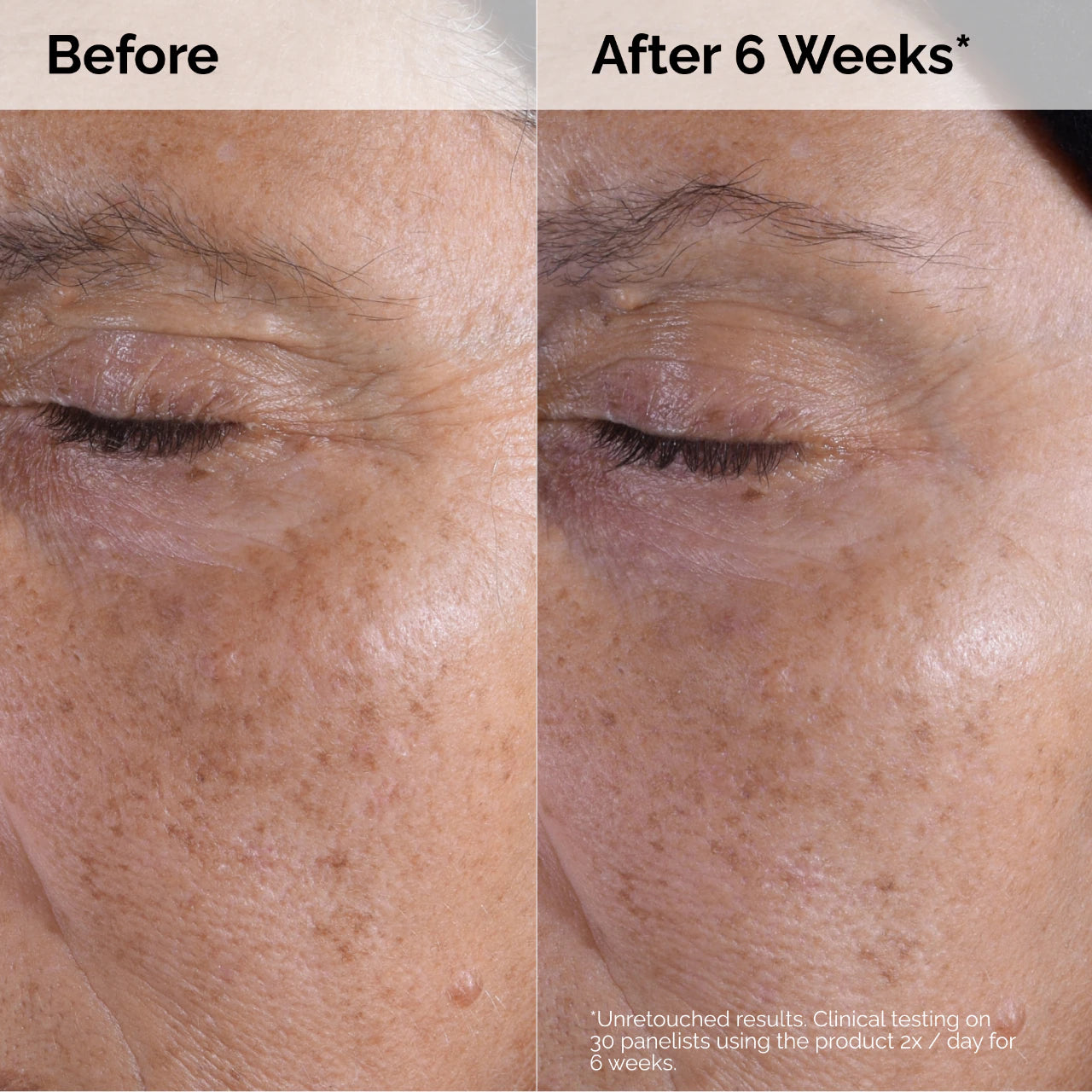 GLYCOLIC ACID 7% EXFOLIATING TONING SOLUTION