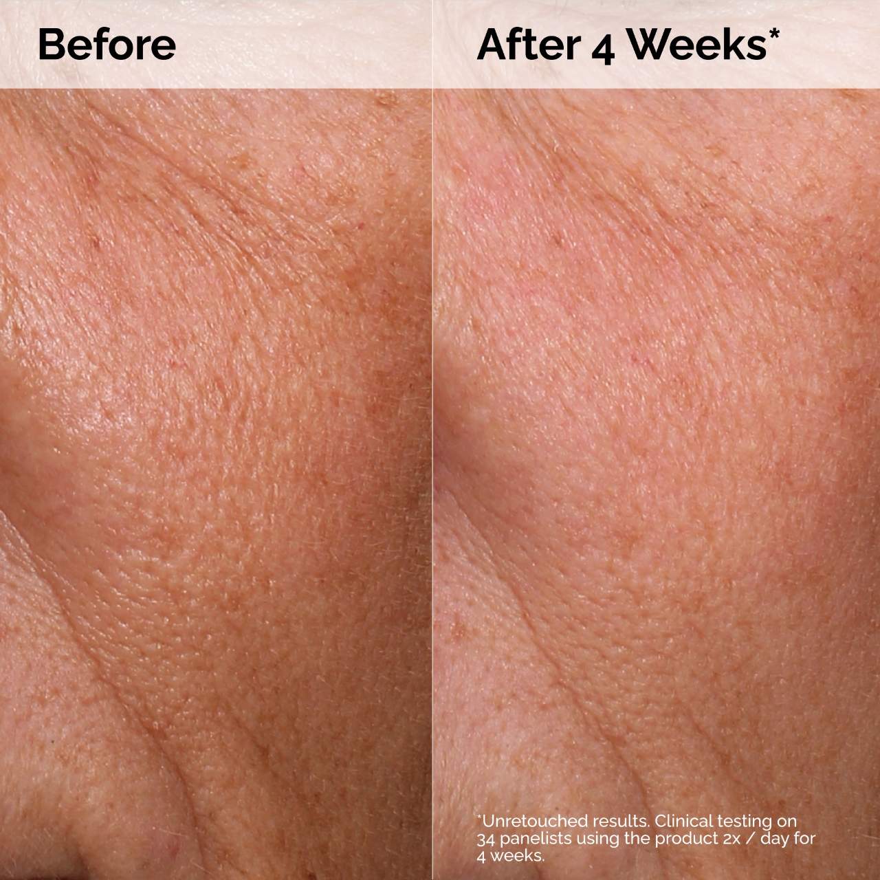 HYALURONIC ACID 2% + B5 HYDRATING SERUM