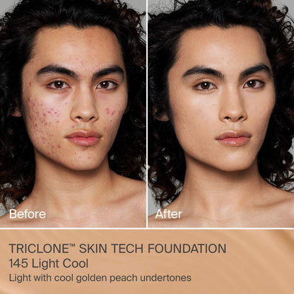 TRICLONE SKIN TECH FOUNDATION