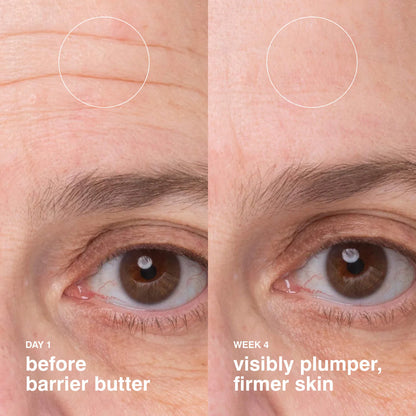 barrier butter intensive moisturizing balm